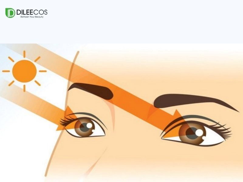 Mắt bị ảnh hưởng khi tia cực tím UV chiếu trực tiếp